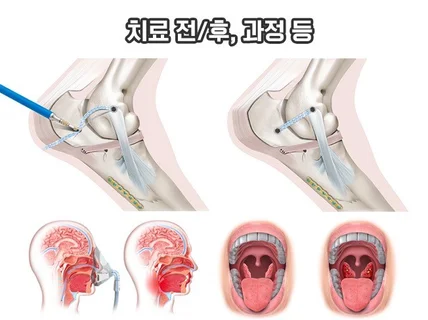 고퀄리티 메디컬,의료,논문 일러스트 제작해 드립니다