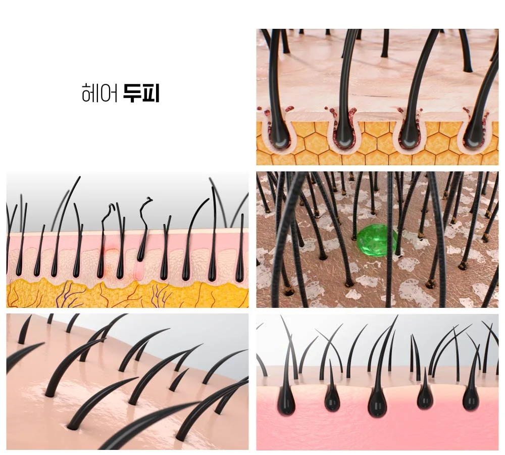 상세이미지-1