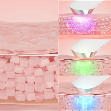 포트폴리오-[3D영상] 루미누보 피부 비포에프터 영상
