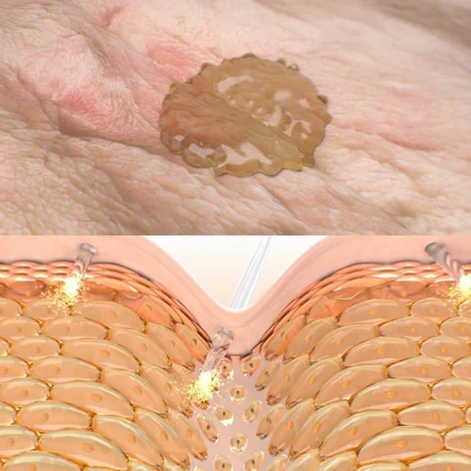 포트폴리오-[3D모델링] 콕스스튜디오_니들제품 피부효과