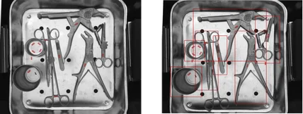 포트폴리오-수술 도구 인식