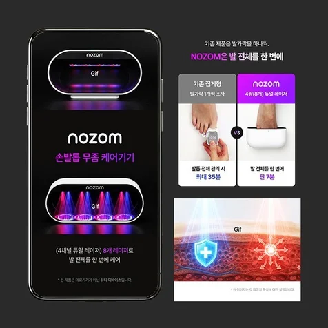 포트폴리오-발톰 무좀 케어 디바이스 상세페이지