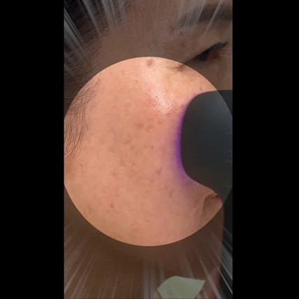 포트폴리오-[기획,촬영,편집] 셀인샷 플라토닝샷