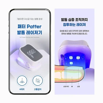 포트폴리오-#패션의류·잡화 발 발톱 레이저기 상세페이지
