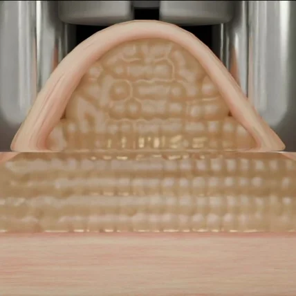 포트폴리오-[3D 영상] '인텐더' 지방흡입 및 분해 디바이스 소구포인트 3D GIF 영상