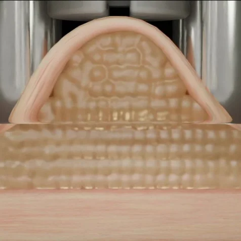포트폴리오-[3D 영상] '인텐더' 지방흡입 및 분해 디바이스 소구포인트 3D GIF 영상