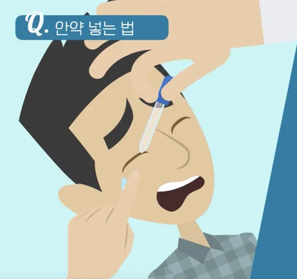 포트폴리오-청주 퍼스트 안과 환자 교육용 영상