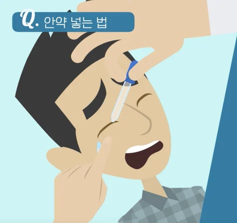 포트폴리오-청주 퍼스트 안과 환자 교육용 영상