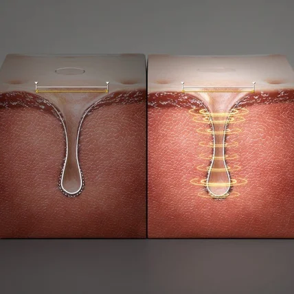 포트폴리오-3D GIF 제작 | 모공 케어 상세페이지 GIF 모델링 렌더링 3D제품 영상