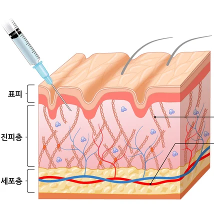포트폴리오-피부 단면 일러스트