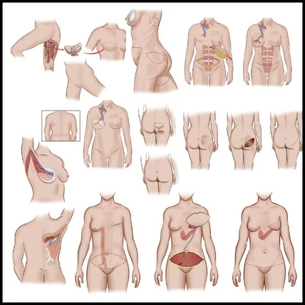 포트폴리오-의료 인체 일러스트