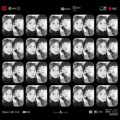 K1*****_썸네일
