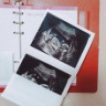 슴슴*****_썸네일